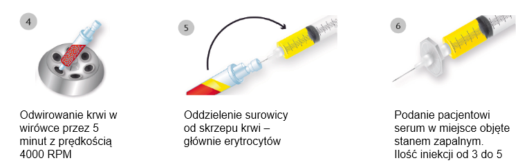 Schemat przygotowania surowicy sanakin