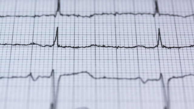 Pracownia EKG